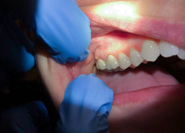 Best Dentist for Severe Toothache  in Lombard, IL